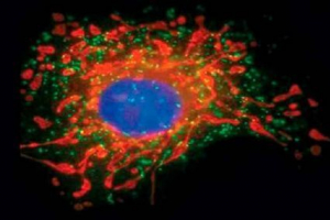 Структура, роль та утворення пероксисом Структура, роль та утворення пероксисом
